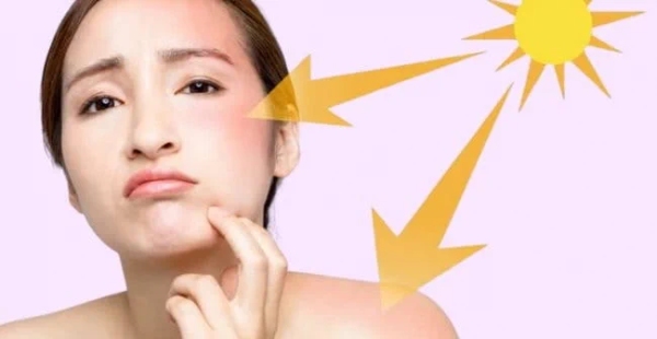 image18-23 Người chạm mặt với biểu cảm lo lắng, nền có hình ảnh mặt trời và mũi tên chỉ vào mặt, biểu thị ánh nắng chiếu.