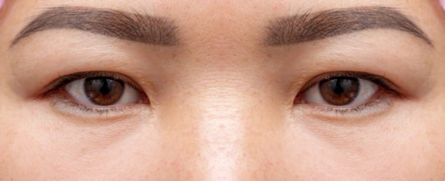 Khám phá nghệ thuật che giấu mắt sưng cùng chuyên gia trang điểm đỉnh cao 8 bi quyet trang diem mat bup kdung 2 42661c2870554701a8b37d8ece0cf8fc 1