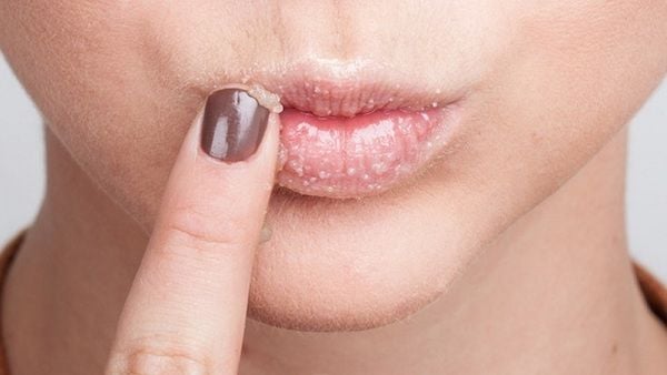 Người đang chạm ng&oacute;n tay v&agrave;o m&ocirc;i c&oacute; lớp da kh&ocirc; hoặc nứt nẻ, biểu thị t&igrave;nh trạng cần chăm s&oacute;c.