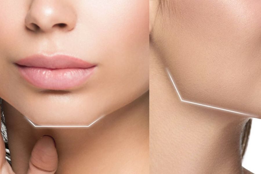 Đặc trưng của khuôn mặt hình vuông