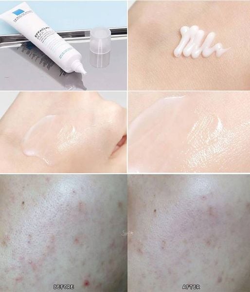 Hình ảnh trình bày một loại kem dưỡng da, cách thoa lên tay và so sánh da trước và sau khi sử dụng.