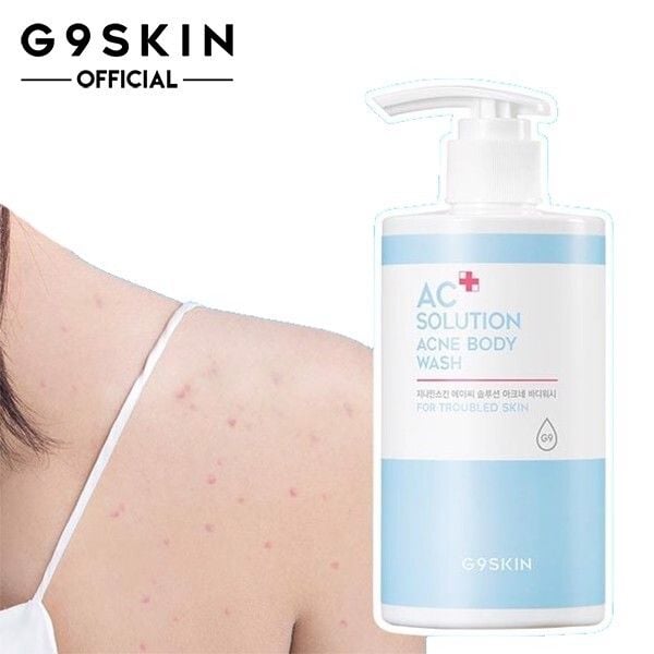 sua_tam_g9skin_ac_solution_acne_body_wash_cho_da_mun_ae9ee04bf2ac4919af3d32d5ffd9485a_grande Chai sữa tắm trị mụn G9Skin bên cạnh phần da có mụn, nền trắng.