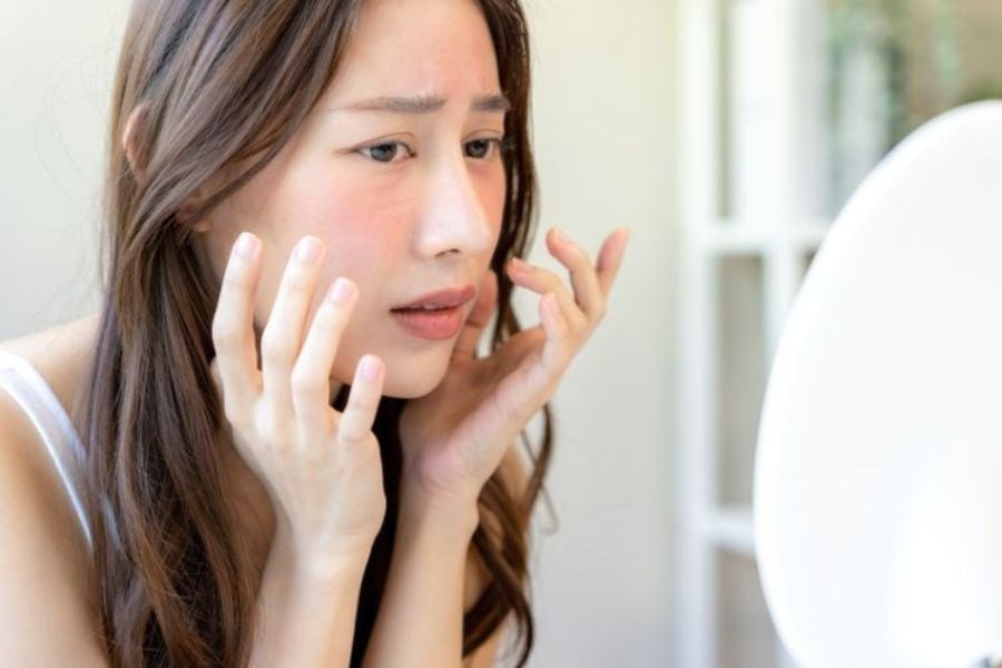 thiet_ke_chua_co_ten__1__d3e9fd11e1d142d1bf5da34a72a32186 Đặc điểm của làn da nhạy cảm